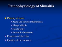 Current Concepts In The Management Of Chronic Sinusitis