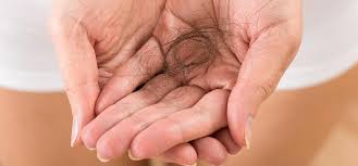 Image result for free images hair loss