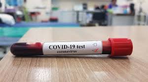 Bila hasil rapid test corona positif, tandanya di tubuh orang yang diperiksa terdapat antibodi virus corona. Cari Tahu Penjelasan Tentang Rapid Test Covid 19 Positif Di Sini Alodokter