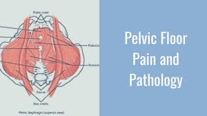 pelvic floor pain and pathology