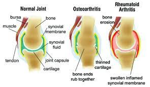 Tristate Arthritis & Rheumatology gambar png