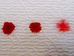 bleeding or spotting in early pregnancy