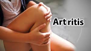 Resultado de imagen para artritis reumatoide
