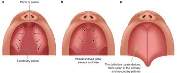 development of cleft lip and palate
