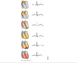 Electrocardiogram Ecg Draw And Label Diagram Quizlet