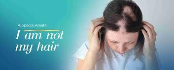 causes of alopecia areata