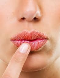 6 ways to prevent chapped lips