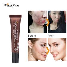 Herbal Acne Scar Remover Treatment Skin Lightening Face Whitening Cream For Dark Spots Melanin Pimple Pigmentation Removal Cream Buy At The Price Of 2 30 In Aliexpress Com Imall Com