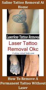 Once these particles are shattered, the immune system gradually takes them away over the following days and weeks. Laser Tattoo Removal Results Easiest Tattoo Color To Remove How To Remove Henna Tattoo Smudges Tattoo Removal Perth How Mu Tatowierungen Tattooentfernung Henna