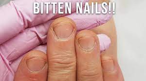 bitten nails get acrylics you