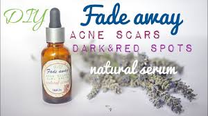 diy acne scar removal serum rosacea