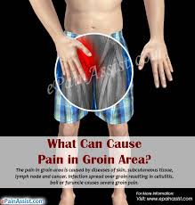 The nerves that connect the groin area pass though the area in the lower back. What Can Cause Pain In Groin Area