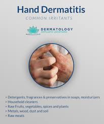 hand dermais everything you should