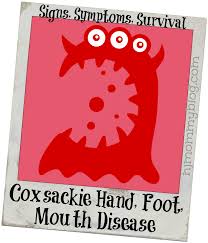 sackie hand foot mouth disease