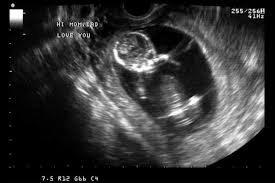 Ich bin mir 100% sicher, dass ich schwanger bin. Ultraschall In Der Schwangerschaft Ab Wann Ist Die Erste Untersuchung Familie De