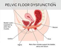 pelvic floor disease doctor in jaipur