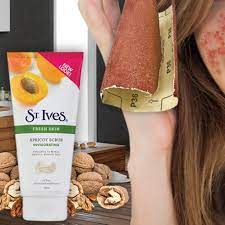 sued for apricot scrub damaging faces