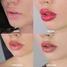 lip blushing is the cosmetic procedure
