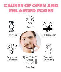 open pores treatment at home your all