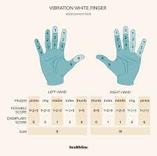 vibration white finger exles