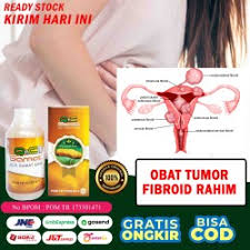 Maybe you would like to learn more about one of these? Jual Tumor Fibroid Murah Harga Terbaru August 2021