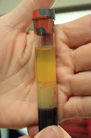 Vacutainer Wikipedia