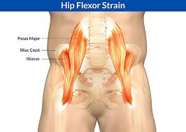 The hip joint can withstand repeated motion and a fair amount of wear and tear. Hip Flexor Tear Strain Orchard Health Clinic