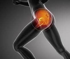 squat may be causing hip pain