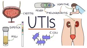 understanding urinary tract infections