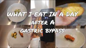 eat in a day after a gastric byp