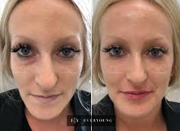 Alexander, take a unique approach to giving patients the results they seek. Face Shaping Facial Contouring Treatments Vancouver