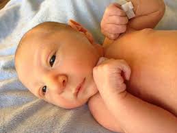 كيفية منع اندماج الطفل المبكر في الجمجمة. تعظم الدروز الباكر أو تعظم الدروز الباكر عند الأطفال: العلاج ، الصور قبل وبعد الجراحة ، الأسباب والأعراض. المسببات المرضية للاضطراب