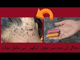 head lice removal anti lice treatment