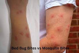 bed bug bites vs mosquito bites how