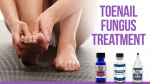 5 best toenail fungus treatment