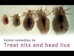 head lice ii remove head lice eggs