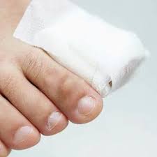 home fungal nail solutions