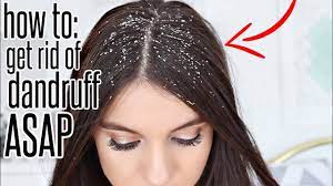 get rid of dandruff after one wash