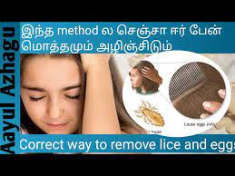 how to get rid of lice and nits tamil
