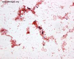 Learn what the gram stain is in microbiology and get the procedure for gram staining bacteria how the gram stain works. Listeria Images Infectious Disease Images Emicrobes Digital Library Atlas