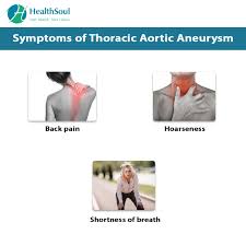 An aneurysm is an abnormal bulge or ballooning in the wall of a blood vessel. Thoracic Aortic Aneurysm Healthsoul