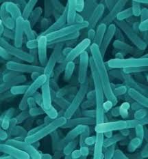 Overview of industries affected by listeria. Listeria Monocytogenes 3 Microscopic Photography Bacterial Diseases Microorganisms