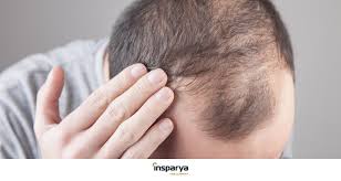 minoxidil what it is for and its side