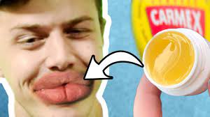 my lips burn carmex lip balm