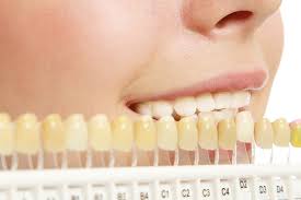 Tooth Whitening System By North Road Dental Centre