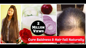 best remedy for hair loss onion juice