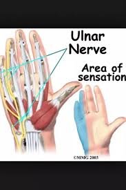 The most common cause of finger pain is a hand injury. What Should I Do For Painful Tingling Sensation Occurring In Both The Pinky And Thumb Area S In Both Hands Quora
