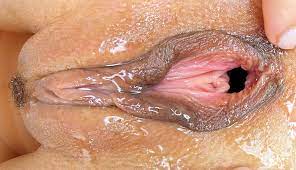 Nasse vagina