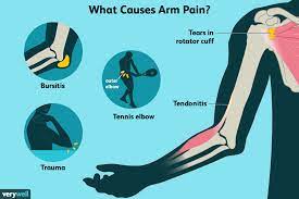 arm pain causes diagnosis and treatment