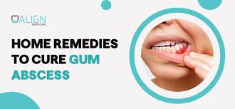 home remes for gum recession